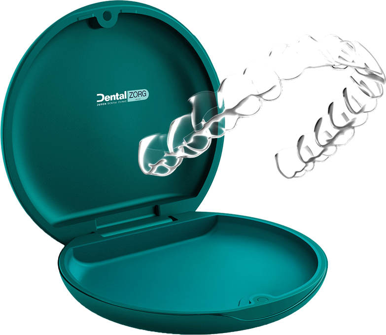 Clear aligners behandeling